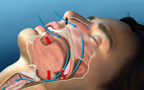 Feature Image